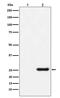 Neuraminidase antibody, M30973-1, Boster Biological Technology, Western Blot image 