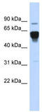 Nuclear Receptor Subfamily 4 Group A Member 2 antibody, TA343589, Origene, Western Blot image 
