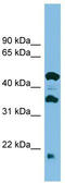 Heat Shock Protein Nuclear Import Factor Hikeshi antibody, TA345028, Origene, Western Blot image 
