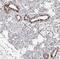 Solute Carrier Family 35 Member D3 antibody, NBP1-81867, Novus Biologicals, Immunohistochemistry paraffin image 