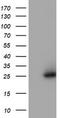 N-Ribosyldihydronicotinamide:Quinone Reductase 2 antibody, TA504781AM, Origene, Western Blot image 