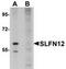 Schlafen Family Member 12 antibody, TA306894, Origene, Western Blot image 