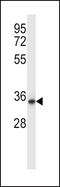 Quinolinate Phosphoribosyltransferase antibody, 57-694, ProSci, Western Blot image 