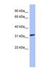 MAGE Family Member B2 antibody, NBP1-56838, Novus Biologicals, Western Blot image 