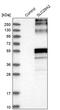 Solute Carrier Family 29 Member 2 antibody, PA5-53746, Invitrogen Antibodies, Western Blot image 