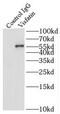 PBEF antibody, FNab09412, FineTest, Immunoprecipitation image 