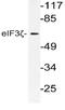 Eukaryotic Translation Initiation Factor 3 Subunit D antibody, AP21173PU-N, Origene, Western Blot image 