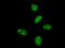 Makorin Ring Finger Protein 3 antibody, LS-C198476, Lifespan Biosciences, Immunofluorescence image 