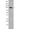 Forkhead Box O3 antibody, PA5-64677, Invitrogen Antibodies, Western Blot image 
