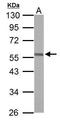 ETS Transcription Factor ERG antibody, GTX100257, GeneTex, Western Blot image 