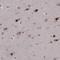 Proteasome 19S S7 antibody, NBP1-87797, Novus Biologicals, Immunohistochemistry paraffin image 