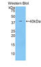Complement C7 antibody, LS-C293487, Lifespan Biosciences, Western Blot image 