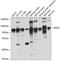 MKS Transition Zone Complex Subunit 1 antibody, A04925, Boster Biological Technology, Western Blot image 