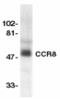 C-C Motif Chemokine Receptor 8 antibody, TA305990, Origene, Western Blot image 