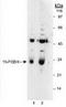 15-Hydroxyprostaglandin Dehydrogenase antibody, TA301413, Origene, Western Blot image 