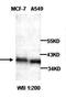 ADP Ribosylation Factor Interacting Protein 2 antibody, orb77114, Biorbyt, Western Blot image 