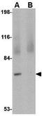 Junctophilin 4 antibody, GTX85365, GeneTex, Western Blot image 