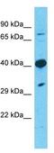 Transmembrane Protein 30A antibody, GTX46298, GeneTex, Western Blot image 