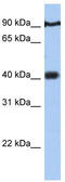 PTOV1 Extended AT-Hook Containing Adaptor Protein antibody, TA339725, Origene, Western Blot image 