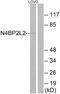 NEDD4 Binding Protein 2 Like 2 antibody, PA5-39341, Invitrogen Antibodies, Western Blot image 