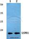LSM1 Homolog, MRNA Degradation Associated antibody, A05573, Boster Biological Technology, Western Blot image 