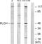 Glycerol-3-Phosphate Acyltransferase 3 antibody, PA5-38698, Invitrogen Antibodies, Western Blot image 