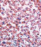 Cytochrome P450 Family 2 Subfamily C Member 9 antibody, LS-C97486, Lifespan Biosciences, Immunohistochemistry paraffin image 