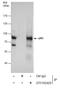 Tumor Protein P63 antibody, GTX102425, GeneTex, Immunoprecipitation image 