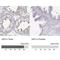 Opa Interacting Protein 5 antibody, NBP2-56649, Novus Biologicals, Immunohistochemistry paraffin image 