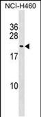 FUN14 Domain Containing 1 antibody, PA5-48853, Invitrogen Antibodies, Western Blot image 