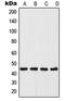 UDP-Glucose Ceramide Glucosyltransferase antibody, LS-C352971, Lifespan Biosciences, Western Blot image 