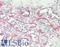 Cadherin 11 antibody, LS-B15836, Lifespan Biosciences, Immunohistochemistry paraffin image 