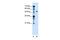 Zinc Finger FYVE-Type Containing 27 antibody, GTX46728, GeneTex, Western Blot image 