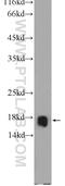 60S ribosomal protein L22 antibody, 25002-1-AP, Proteintech Group, Western Blot image 