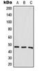Aurora Kinase A antibody, LS-C354094, Lifespan Biosciences, Western Blot image 