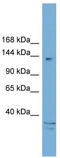 AT-Rich Interaction Domain 5B antibody, TA339767, Origene, Western Blot image 