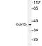 Cyclin Dependent Kinase 10 antibody, LS-C176934, Lifespan Biosciences, Western Blot image 