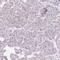 HMP antibody, HPA036164, Atlas Antibodies, Immunohistochemistry paraffin image 