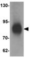 LRRFIP1 antibody, GTX17100, GeneTex, Western Blot image 