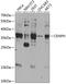 Centromere Protein H antibody, GTX33090, GeneTex, Western Blot image 