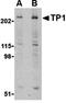 Telomerase Associated Protein 1 antibody, orb74430, Biorbyt, Western Blot image 