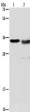 Cathepsin L antibody, TA349265, Origene, Western Blot image 
