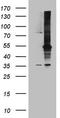 Mitogen-activated protein kinase kinase kinase 8 antibody, TA808459, Origene, Western Blot image 