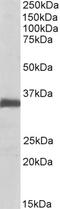 Protein Kinase AMP-Activated Catalytic Subunit Alpha 2 antibody, 42-828, ProSci, Western Blot image 