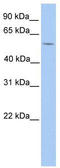 LIM Domains Containing 1 antibody, TA339713, Origene, Western Blot image 