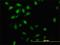 DNA-binding protein inhibitor ID-3 antibody, H00003399-M02, Novus Biologicals, Immunocytochemistry image 