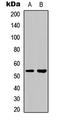 Cytosolic beta-glucosidase antibody, LS-C356054, Lifespan Biosciences, Western Blot image 