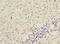 Intercellular Adhesion Molecule 4 (Landsteiner-Wiener Blood Group) antibody, LS-C675878, Lifespan Biosciences, Immunohistochemistry paraffin image 