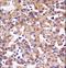 M-PST antibody, LS-C161605, Lifespan Biosciences, Immunohistochemistry paraffin image 