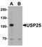 USP21 antibody, PA5-38034, Invitrogen Antibodies, Western Blot image 